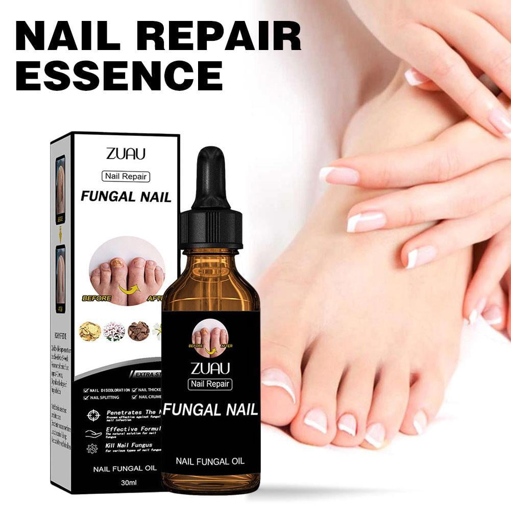 BE Nail Repair Essence Removes Onychomycosis Serum Fungal Nail ...