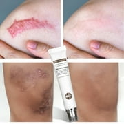 BECLOTH Scar Removal Scar Marks For Face or Body
