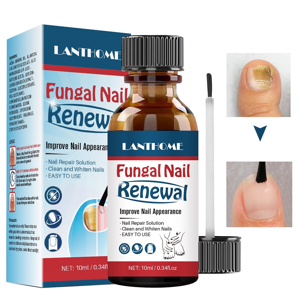 BEUKING Nail Repair Essnce Liquid, Fingernail and Toenail Repair, Fix