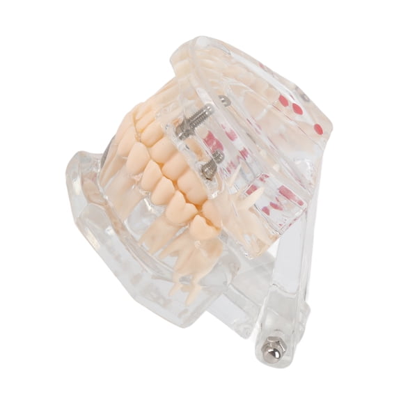 BIMZUC New Dental Teaching Study Standard Tooth Model Demonstration Disease Educational Tool, 3.54 in / 9 cm