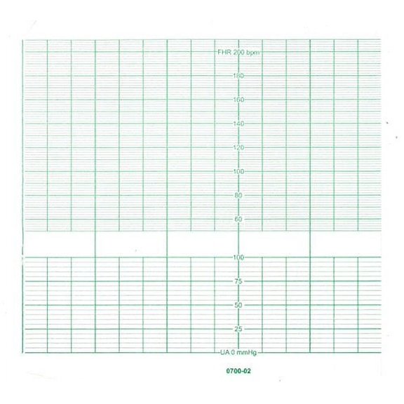 BIONET CARDIOCARE ECG Paper 152MM X 25M (5)