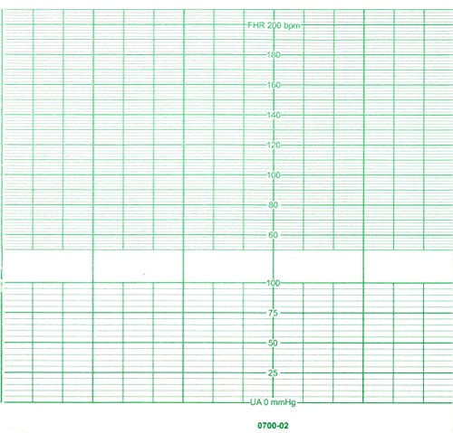 BIONET CARDIOCARE FETAL Monitor Paper 152MM X 25M (10)