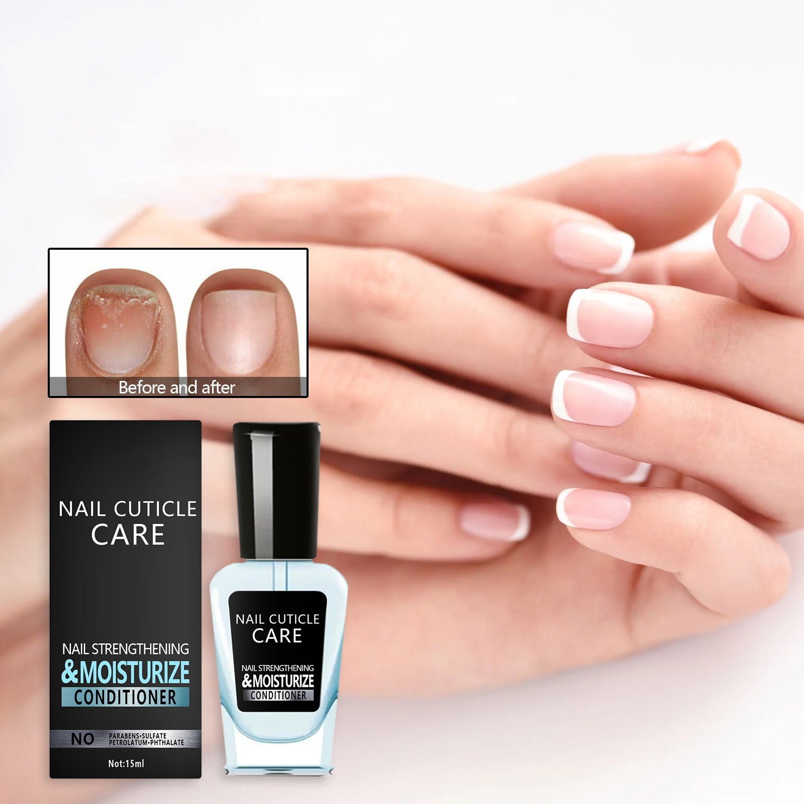 BNIXIREN Solution For Repairing Hands Feet Gray Nails Rotten Nails