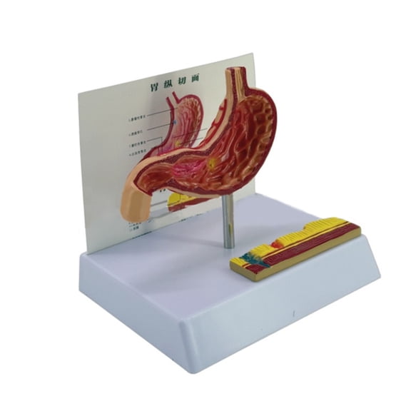 BQBQERT Anatomical Stomach Perforation Model Pathological Gastric Anatomy Model for Teaching Demonstration and Educational