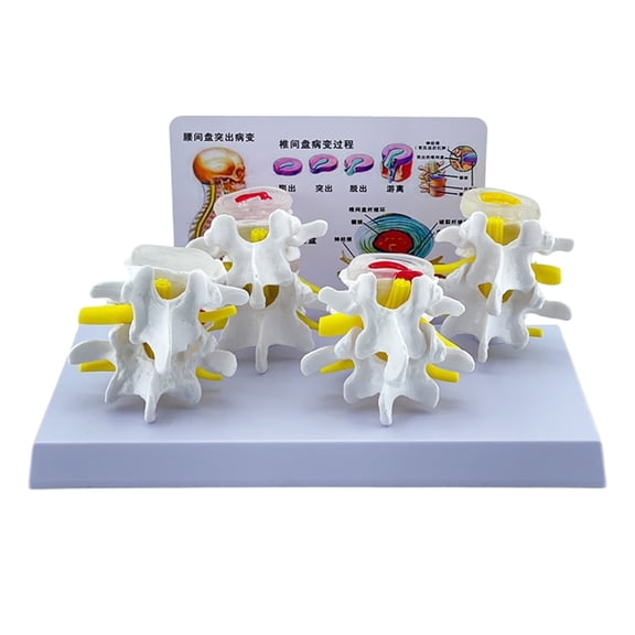 BQBQERT Human Lumbar Vertebrae Model Medicals Teaching Tool Human Lumbar Spine Anatomy Model School Teaching Supplies