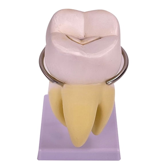 BQBQERT Teeth Model Pathology Model Molar Tooth Model, Anatomy Model for Medical Science Dentist Dentistry