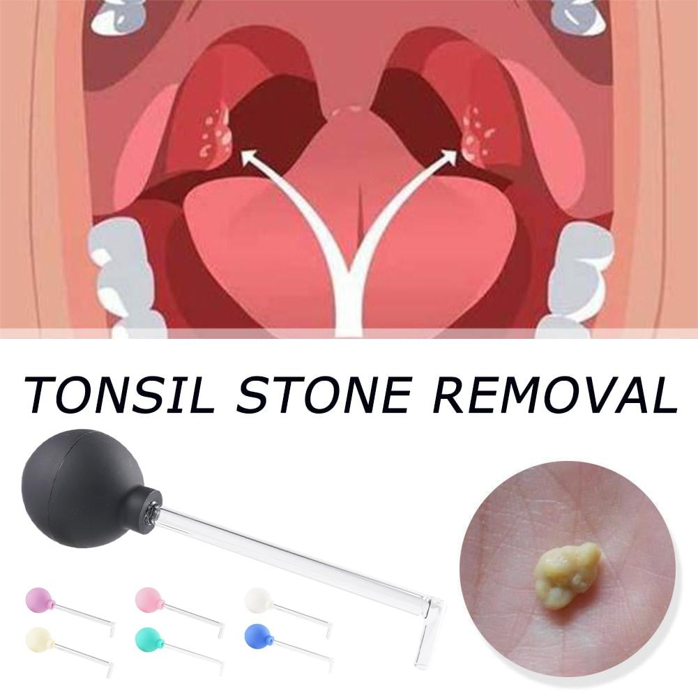 BQLQBQLQ Tonsil Stone Remove Tool Cleaner Removal Manual Style Mouth ...
