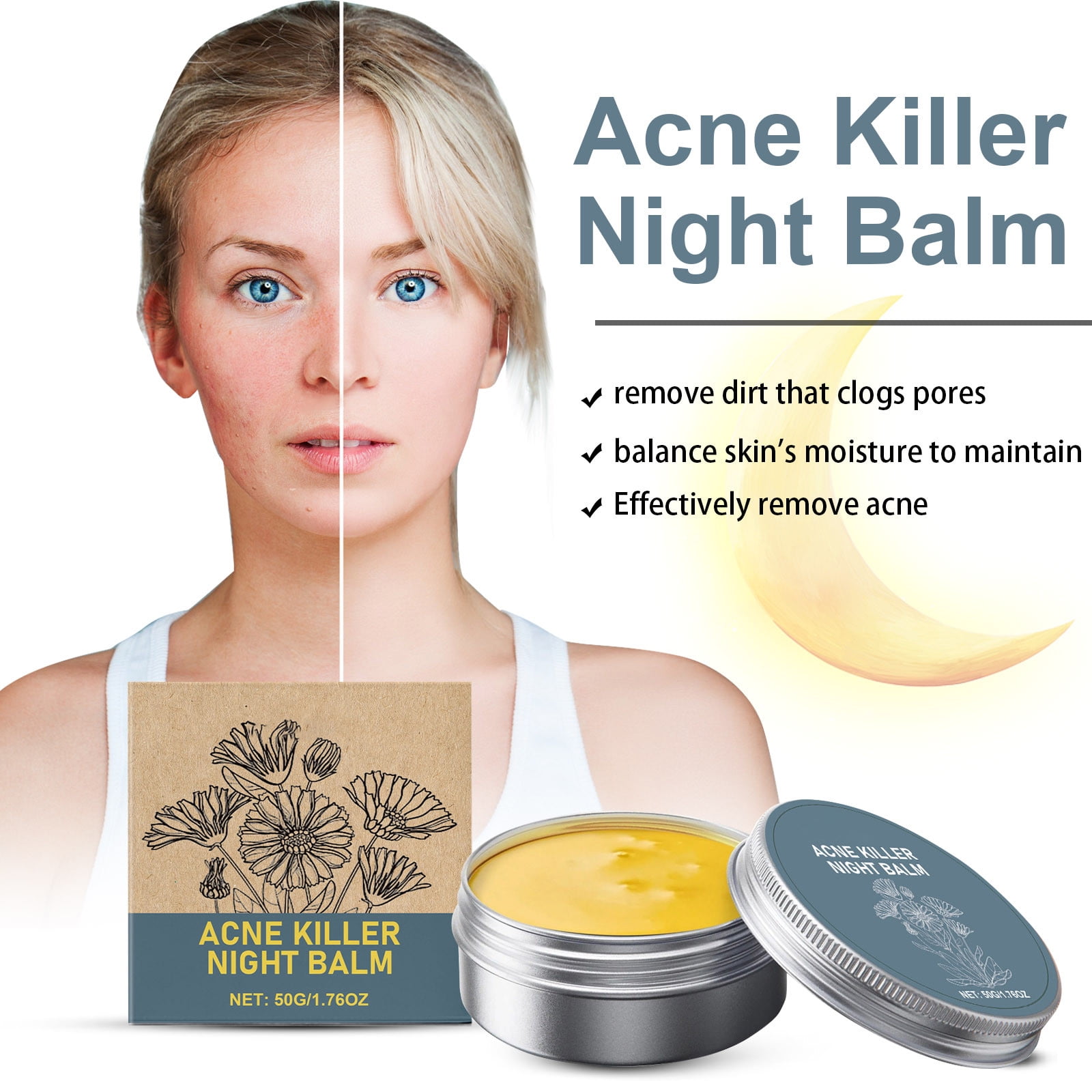 BRISEZZS Nuevos Productos! Acne Night Balm, Facial Care Cream, Acne
