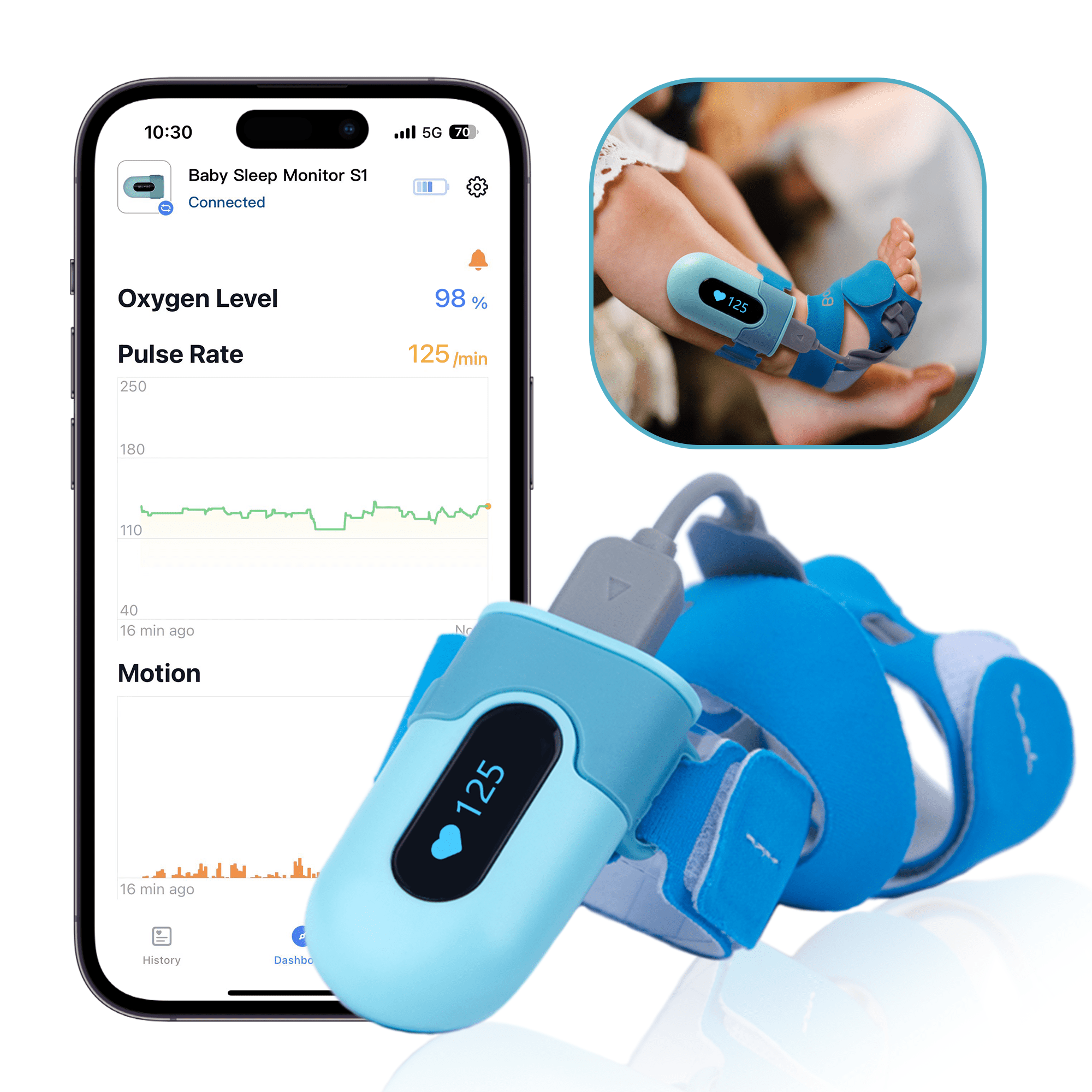 Babytone Baby Sleep Monitor, Oxygen Monitor for Tracking Heart Rate, Avg oxygen levels