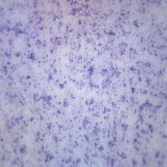 Bacillus Culture, Gram Positive & Negative - Prepared Microscope Slide ...