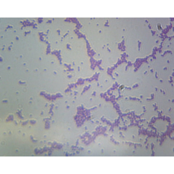 Bacillus; Smear; Gram-Negative by Go Science Crazy