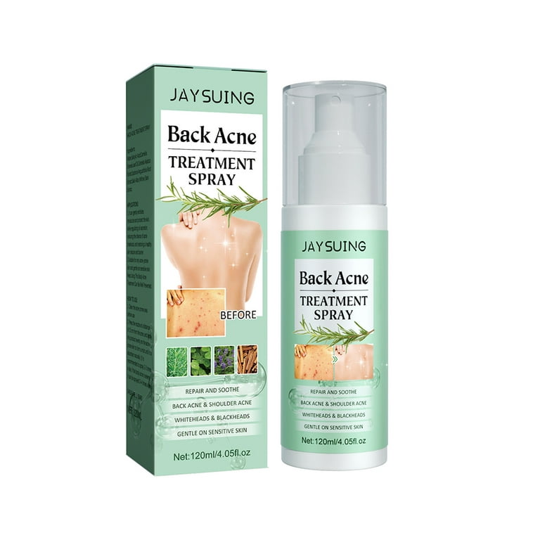 Back Acne Treatment Spray, 120ml Back Acne Treatment Spray, Repair Back  Shoulder Acne Lighten Acne Marks Skin Care Spray 