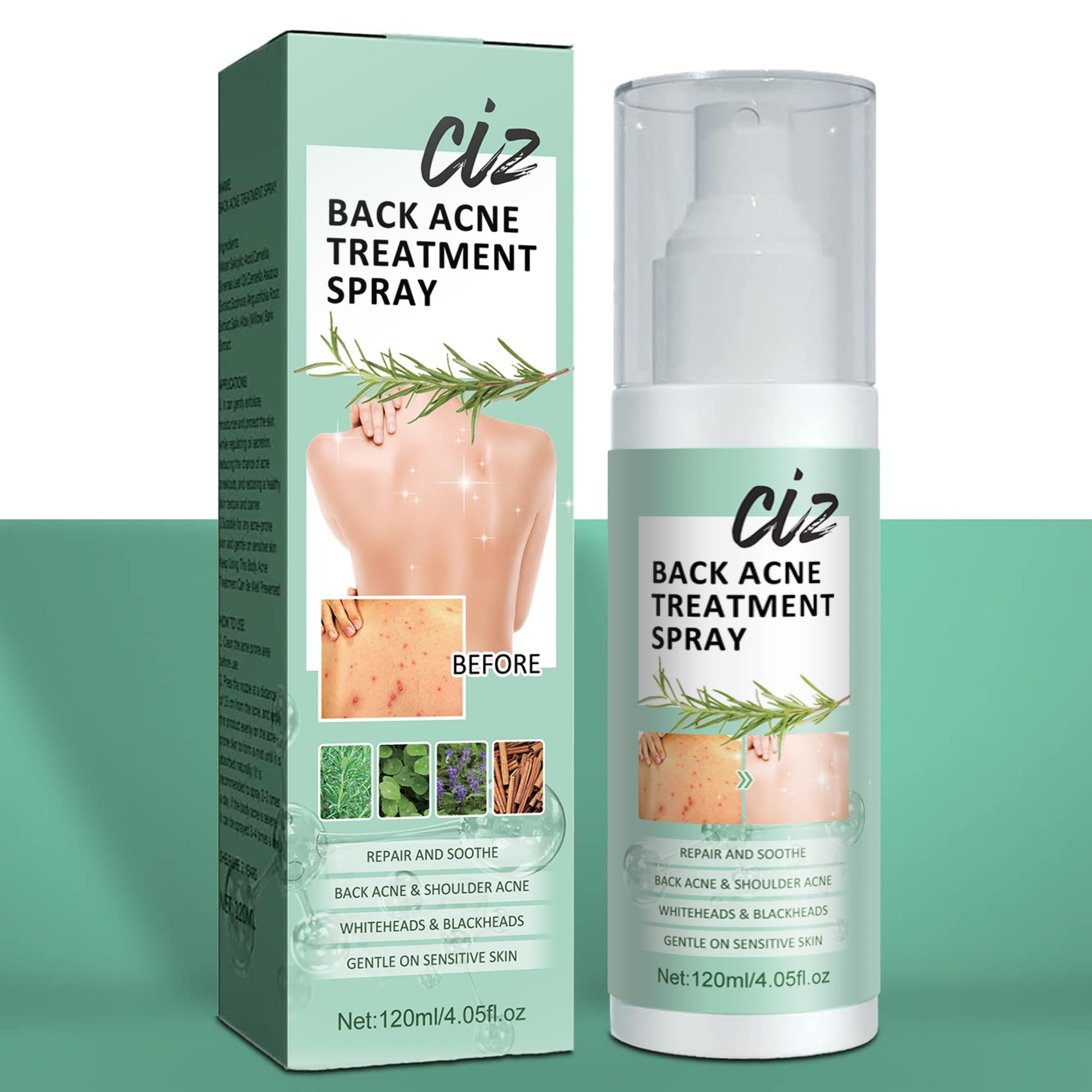 Back Acne Treatment, Back Acne Spray, 2 Salicylic Acid Spray, Body