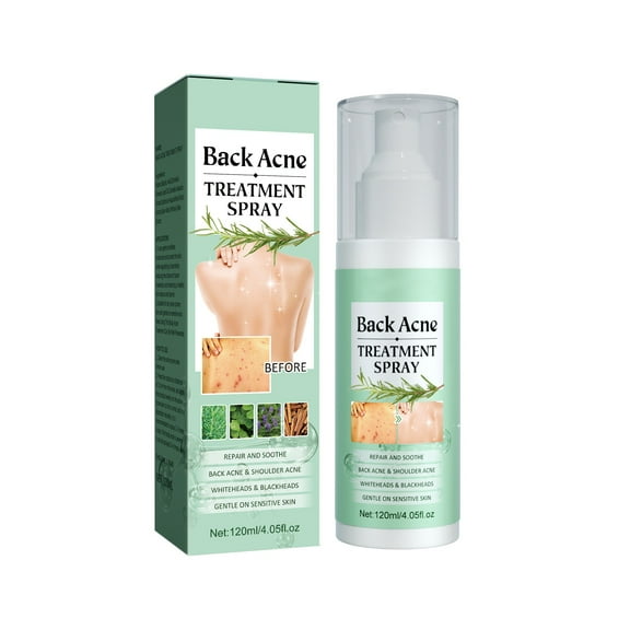 Back  Treatment, Back  Spray, 2% Salicylic Acid Spray, Body Treatment with Herbal Formula, Body Spray, Tea Tree Oil Spray, Treatment For Teens, Back  Solution，120ml 1PCS