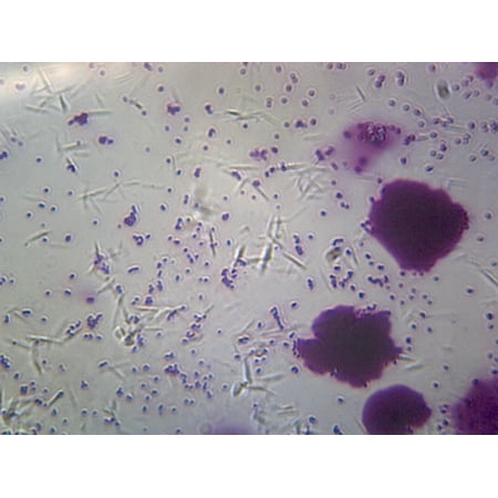 Bacteria from Human Mouth, Showing Different Types; Smear by Go Science Crazy