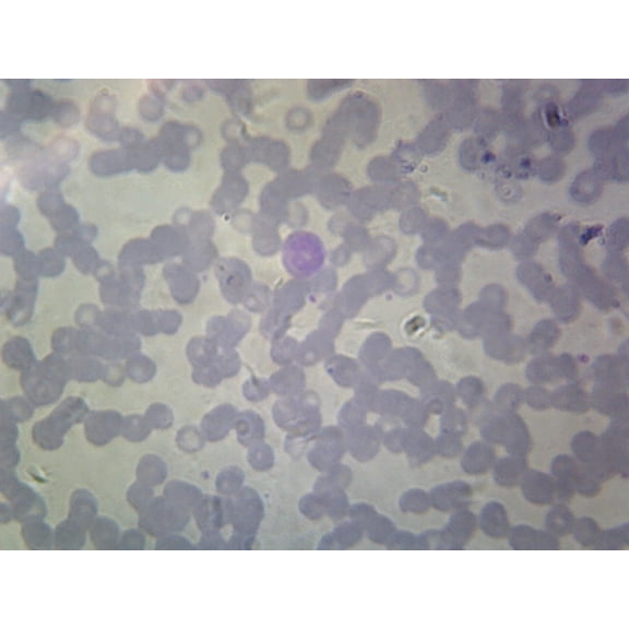 Balantidium Coli Trophozoites; Smear by Go Science Crazy