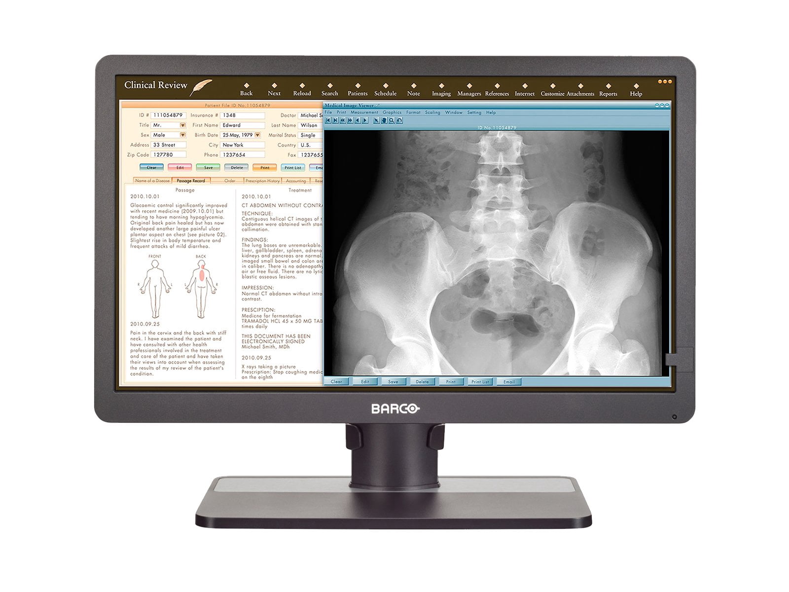 24" Barco Eonis MDRC-2324 Snib 2MP Clinical Review LED Monitor K9350055