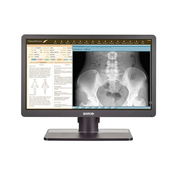24" Barco Eonis MDRC-2324 Snib 2MP Clinical Review LED Monitor K9350055