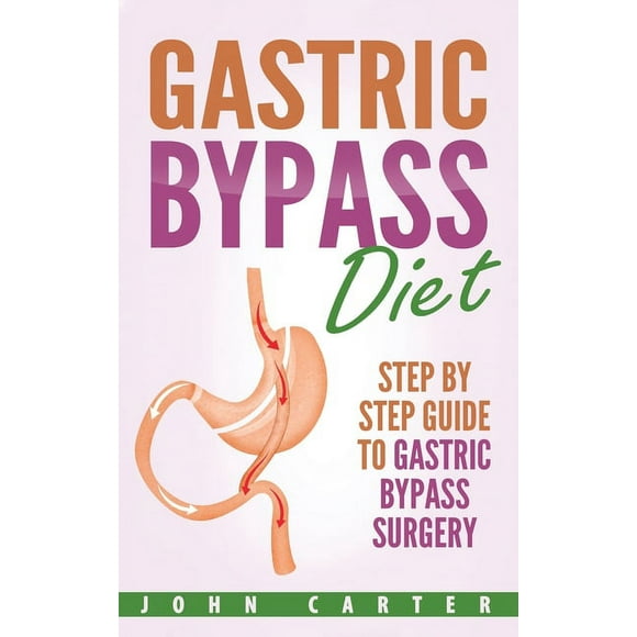 Bariatric Cookbook: Gastric Bypass Diet : Step By Step Guide to Gastric Bypass Surgery (Series #2) (Hardcover)