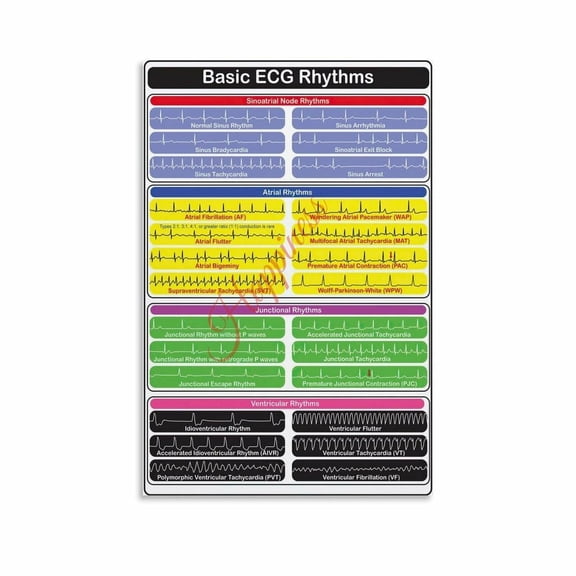 Basic ECG Rhythm Poster ECG Knowledge Posters Canvas Painting Wall Art Poster for Bedroom Living Room Decor