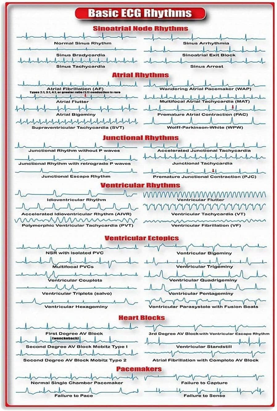 Basic Ecg Rhythms Infographic Metal Sign Cardiology Study Guide Tin ...