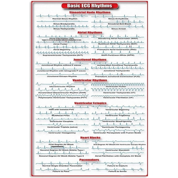 Basic Ecg Rhythms Infographic Metal Sign Cardiology Study Guide Tin Poster Cardiologist Office Decor Doctor Hospital Home Wall Dcor 8x12 inches