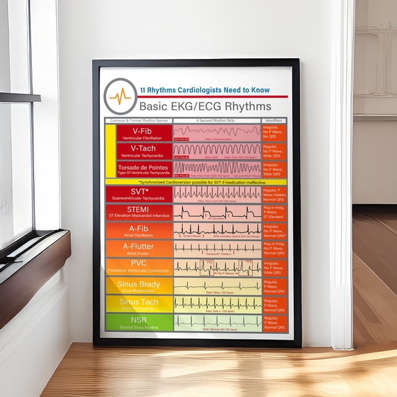 Basic Ekg Ecg Rhythms Medical Knowledge Wall Art Nursing School Decor ...