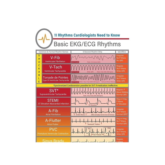 Basic Heart Rhythms EKG Interpretation Poster Canvas Wall Decor Art ...