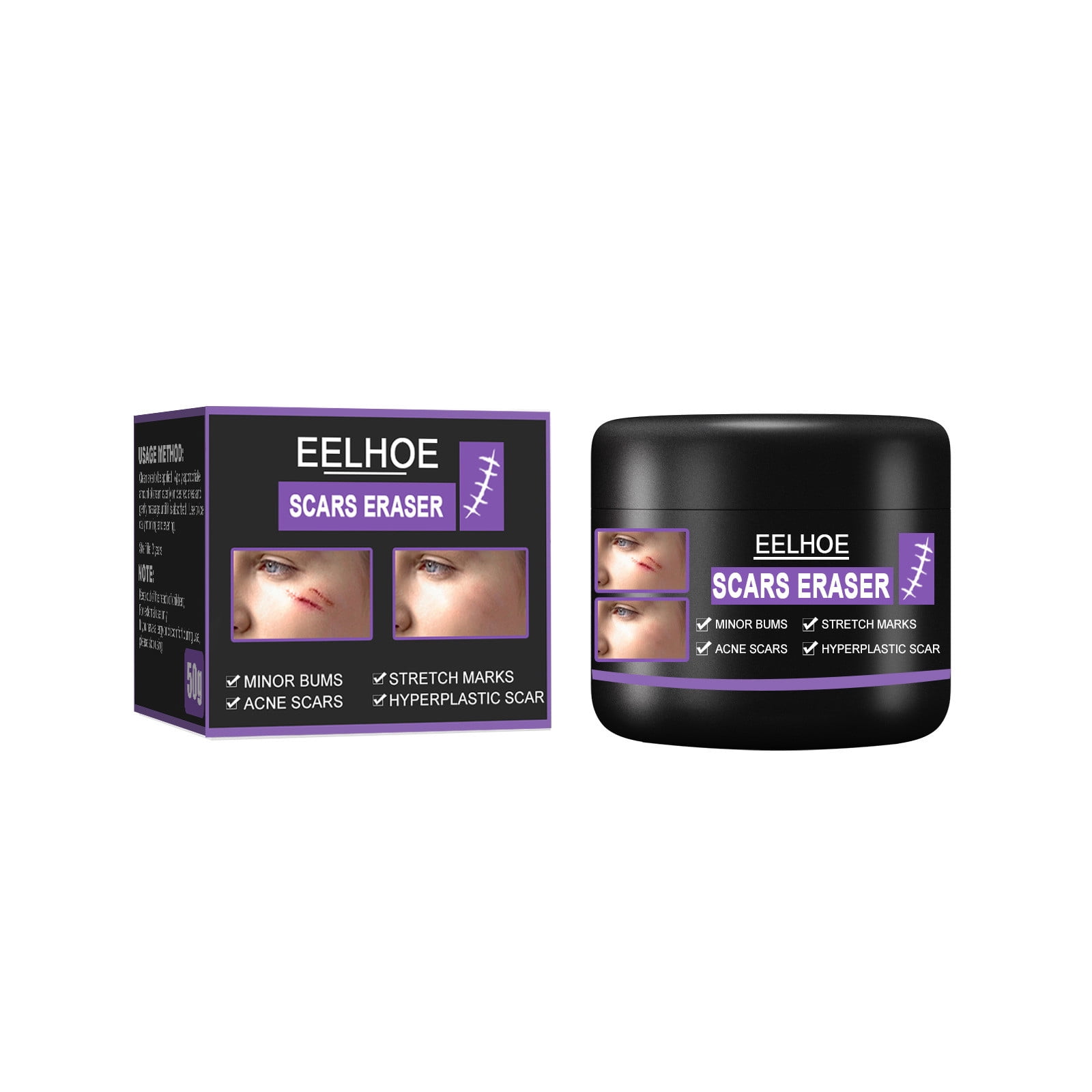 Baycosin Scar Removal Cream Stretch Marks Relief And Burns Repair Acne