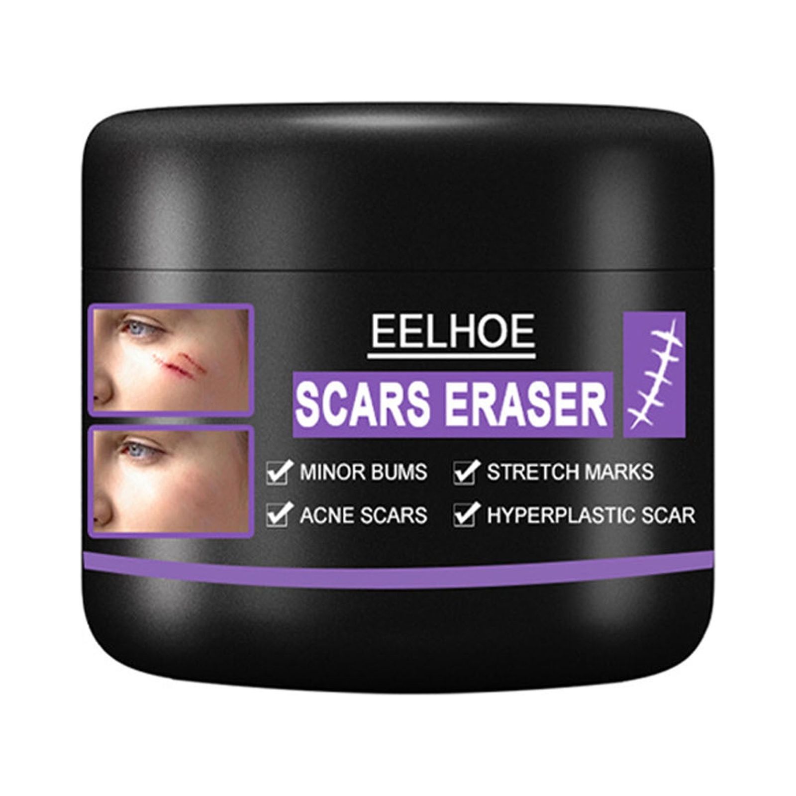 Baycosin Scar Removal Cream Stretch Marks Relief And Burns Repair Acne