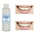 Beastres Big Deals Teeth Whitening Strips,Water Picks For Teeth
