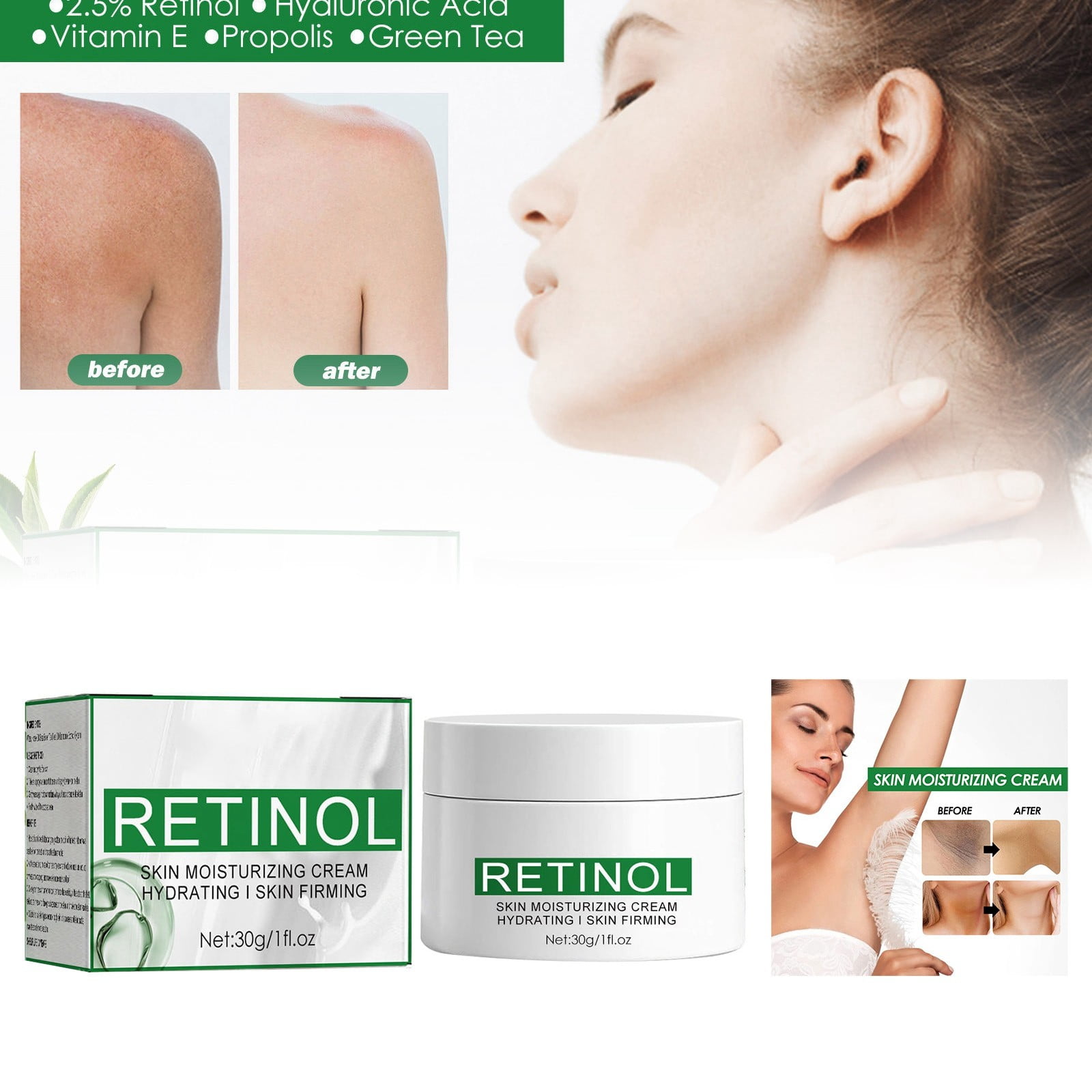 Beauty Fade Dark Skin On Joints Womens Ideas Self Care New Mom Care