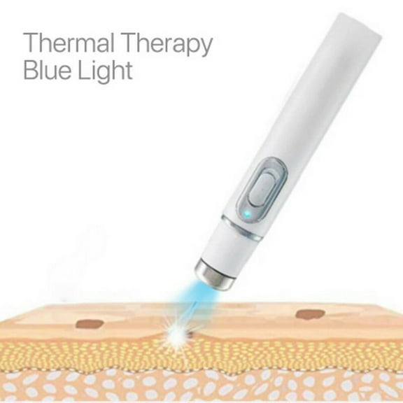 Beauty Tool Health Care Devices Home Trea Tment Set Blue Light Varicose Vein Trea Tment Pen Suitable For Spi Der Veins 1