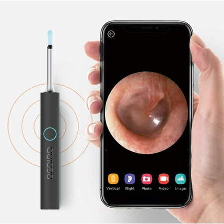 Bebird W3 Ear Cleaning Otoscope, Blue: 5 Attachments, 1080P Camera: Wireless Connection