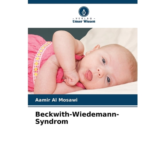 Beckwith-Wiedemann-Syndrom, (Paperback)