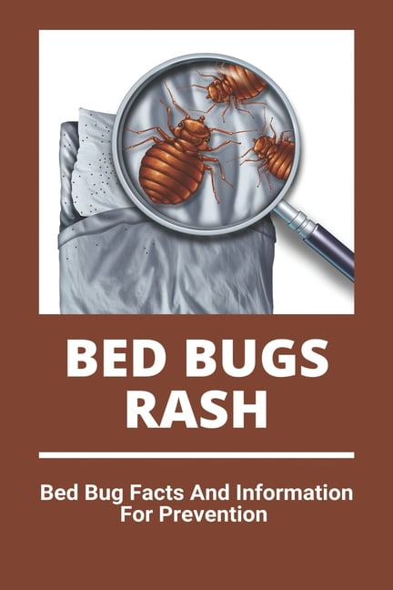 Bed Bugs Rash, (Paperback) - Walmart.com