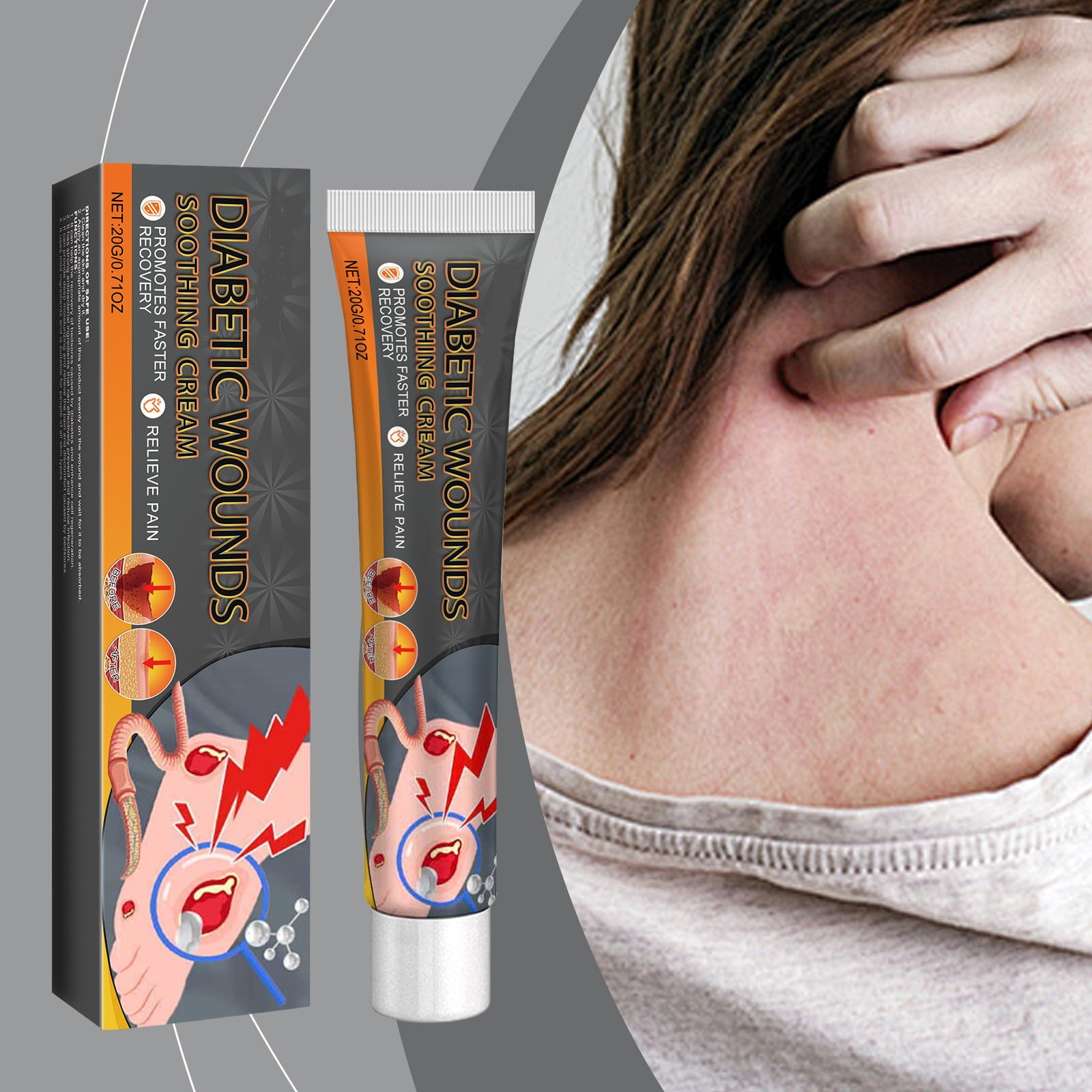 Bed Sore TreatmentCream, Bedsore Ointment,Bed Sores HealingCream