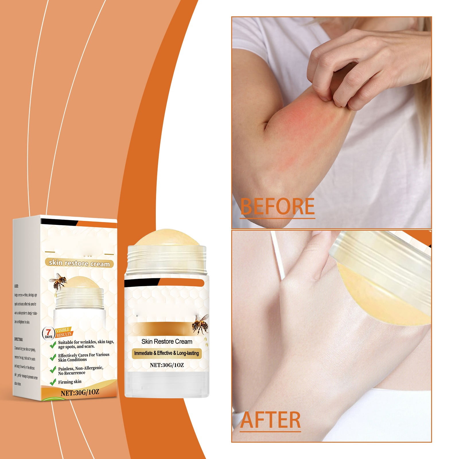 Bee Extract Skin Cream – Reduces Wrinkles, Skin Tags & Age Spots ...