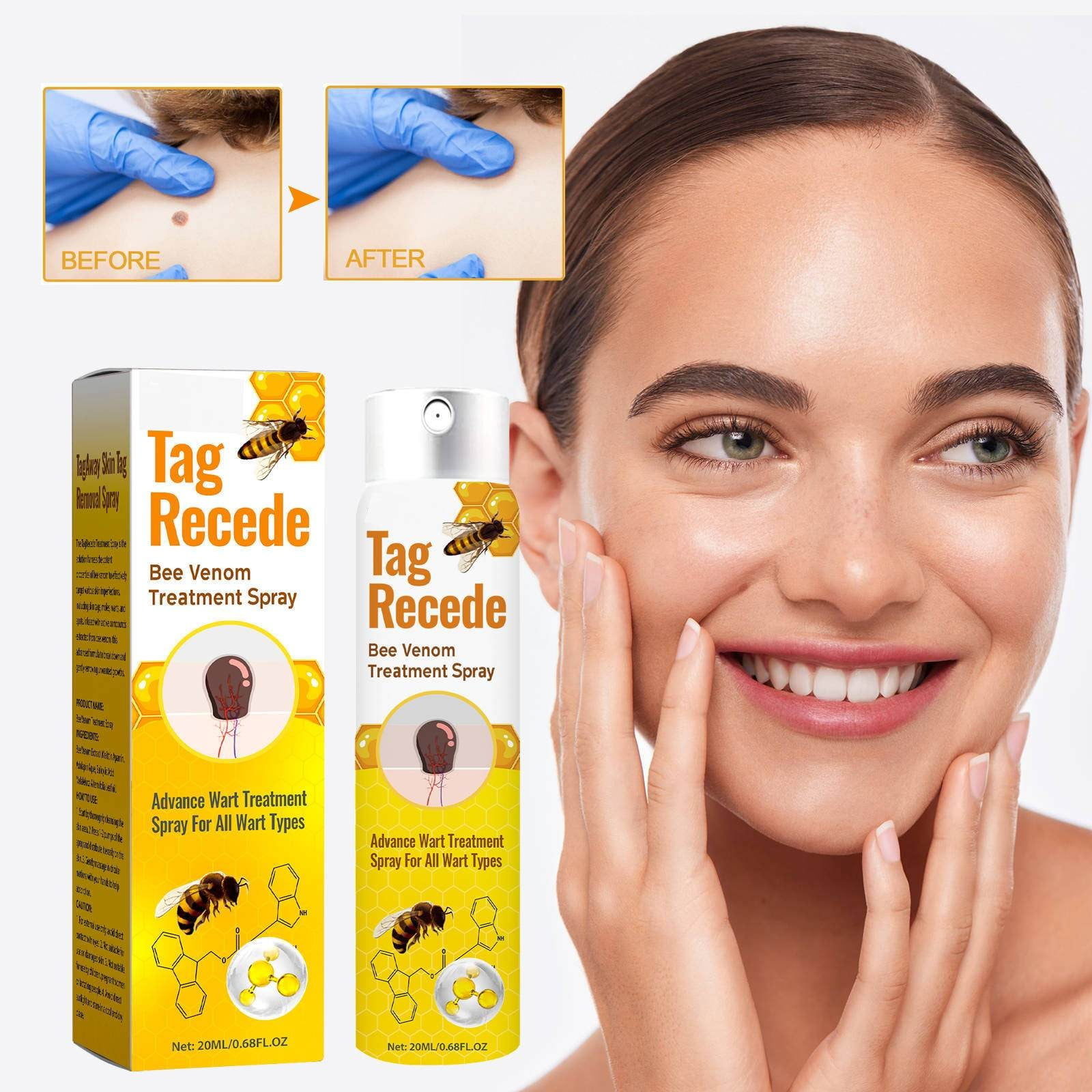 Bee Spray Male And Female Bee Label Spray Remove Warts Improve bee-spray-male-and-female-bee-label-spray-remove-warts-improve