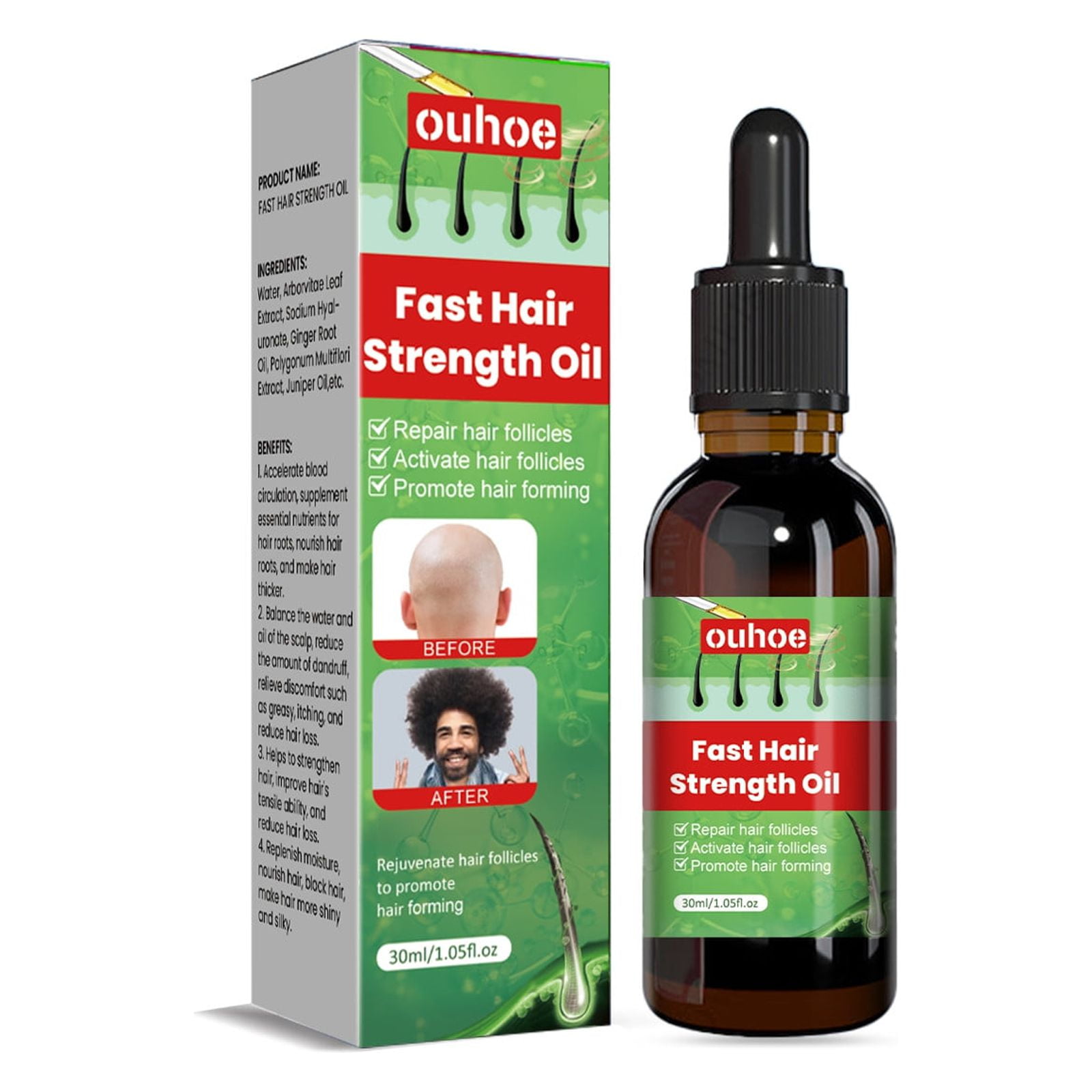 Beessbest Fast Hair Growth Oil Hair Growth Essential Oil Hair Care to ...