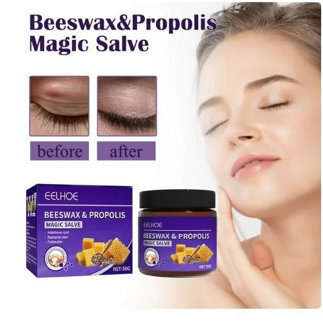 Beeswax and Propolis Magic Salve Hidradenitis suppurativa Boils and