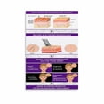 thumbnail image 1 of Benefits of Microneedling Medical Beauty Poster (8) Canvas Painting Wall Art Poster for Bedroom Living Room Decor, 1 of 4