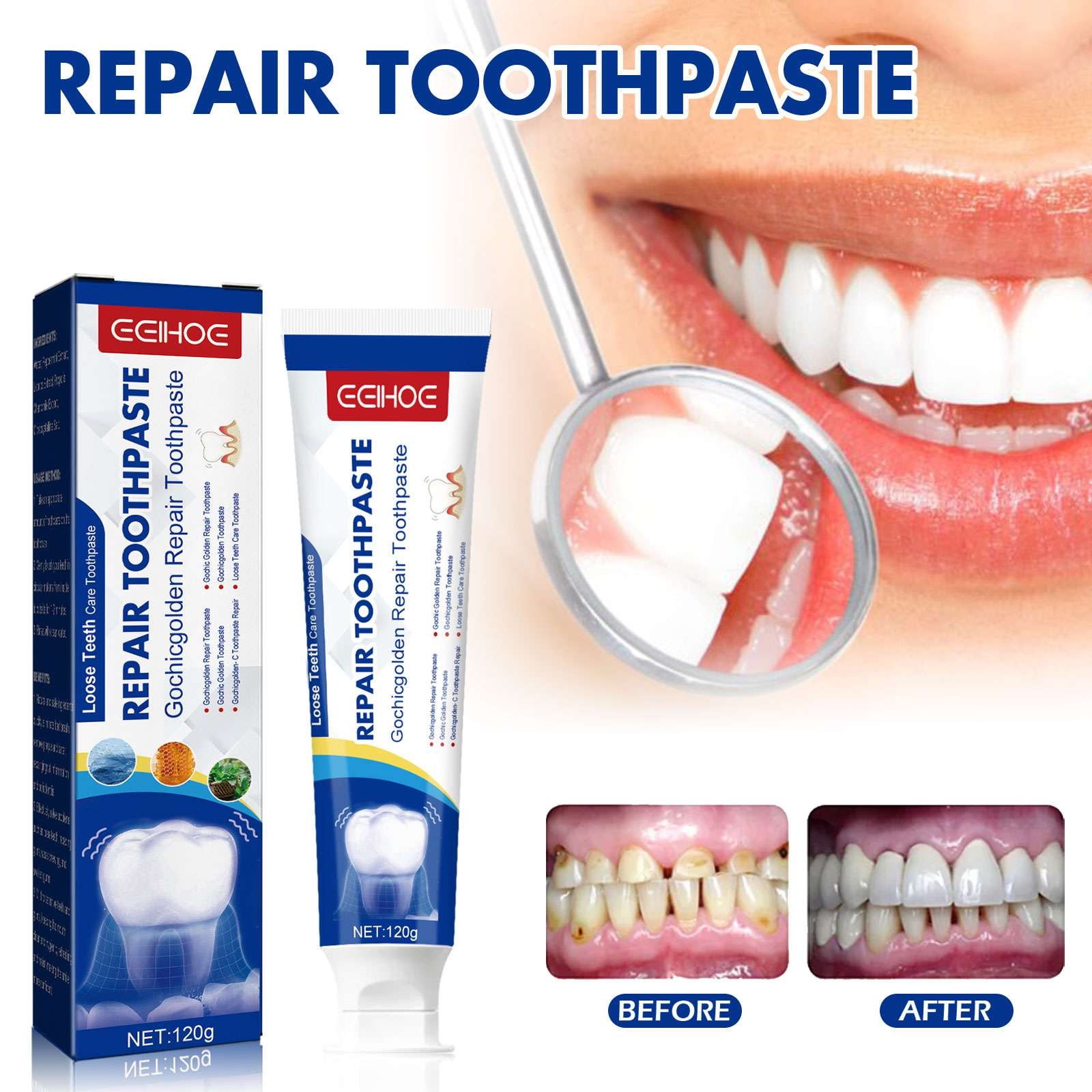 EXAXTA Repair Toothpaste forEarly & Mid Periodontitis, Gingivitis