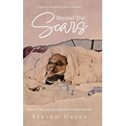 Beyond The Scars A Journey of Resilience, Hope, and Power, Hardcover