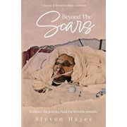 Beyond The Scars A Journey of Resilience, Hope, and Power, Paperback