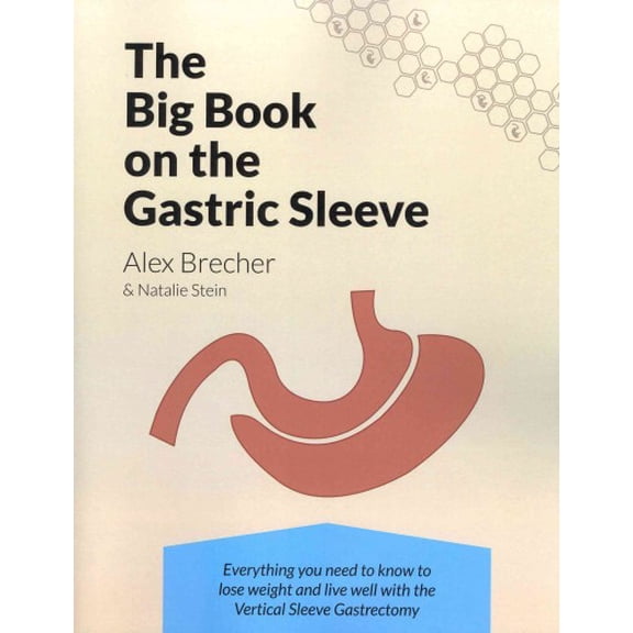 The Big Book on the Gastric Sleeve: Everything You Need to Know to Lose Weight and Live Well with (Paperback) by Natalie Stein, Alex Brecher