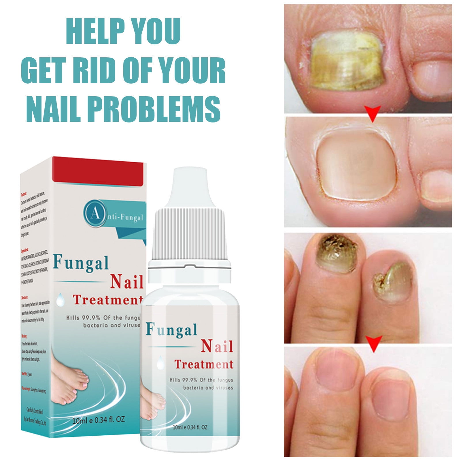 Bigwheat Nail Repair Lotion - 10ml Anti-Fungal Nail Care Solution for Onchomycosis and Moisturizing