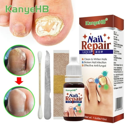 Bilqis Nail Repair Fluid Toenail And Nail Solution Toenails And Nails Repair Damaged And Discolored Nails 10ML