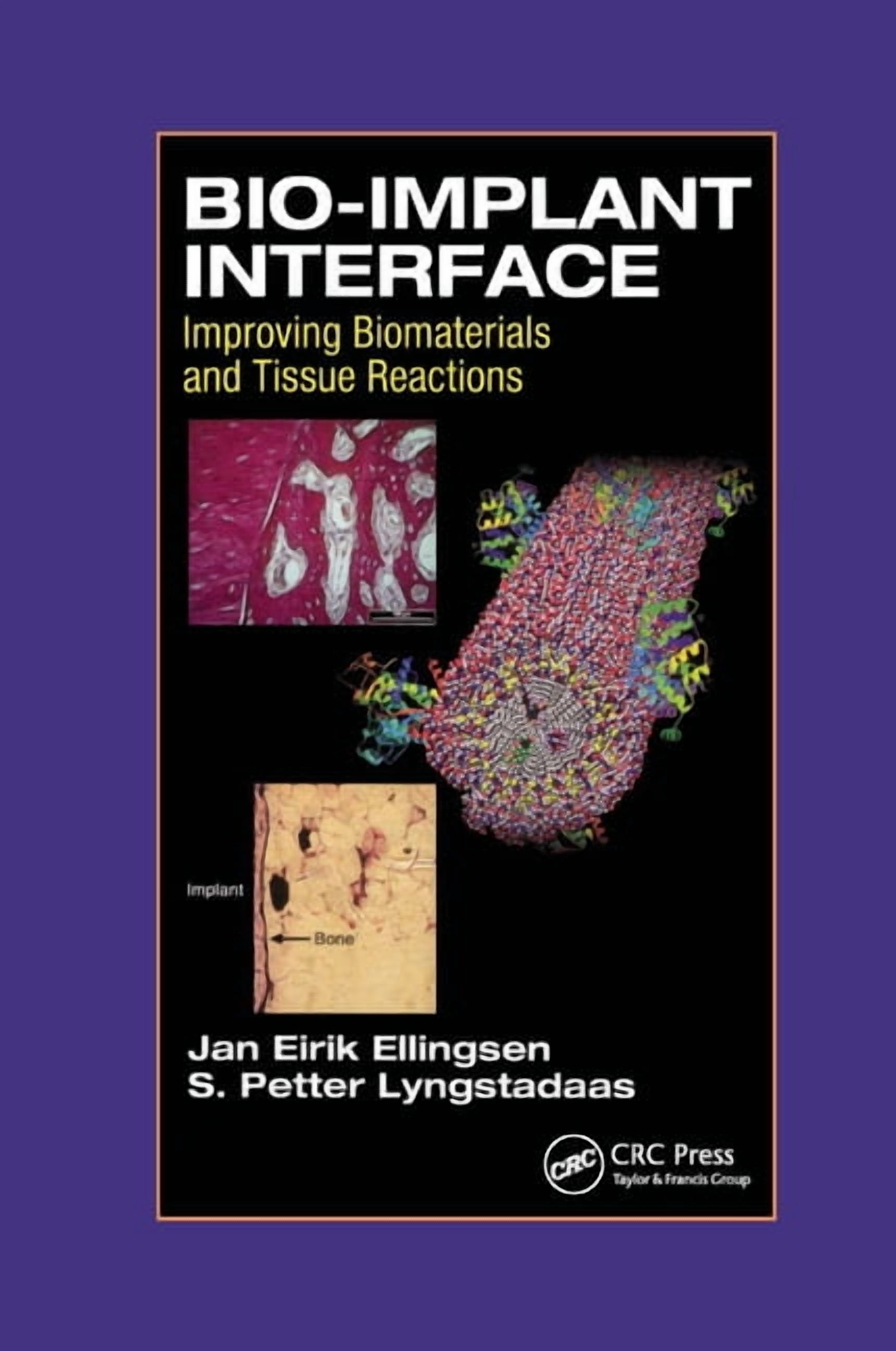 Bio-Implant Interface: Improving Biomaterials and Tissue Reactions ...