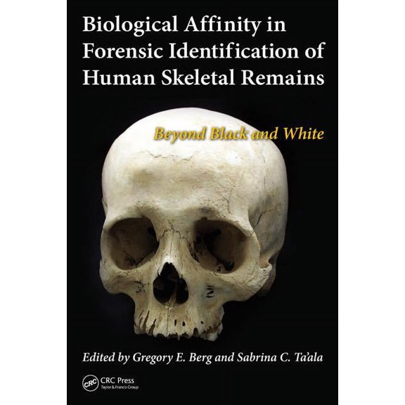 Biological Affinity in Forensic Identification of Human Skeletal Remains: Beyond Black and White, (Hardcover)